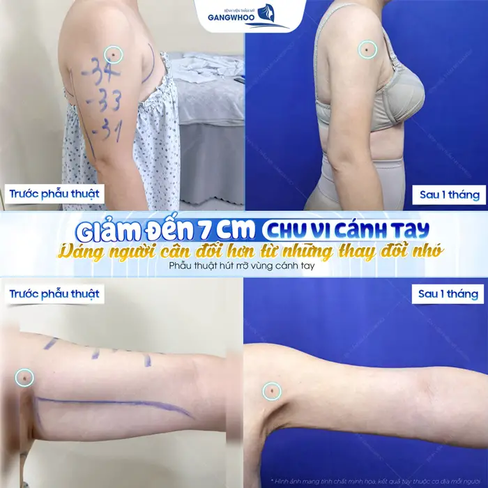 Giảm 7 cm chu vi cánh tay dánh người cân đối từ nhũng thay đổi nhỏ sau 1 tháng đã thon đẹp xuất sắc