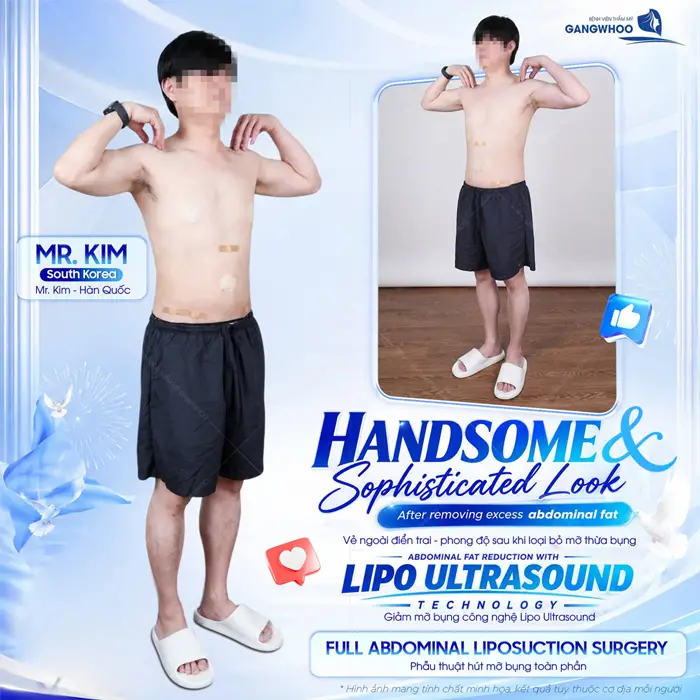 Giảm mỡ bụng công nghệ Lipo Ultrasound vẻ ngoài điển trai và thêm phong độ sau khi loại bỏ mỡ bụng