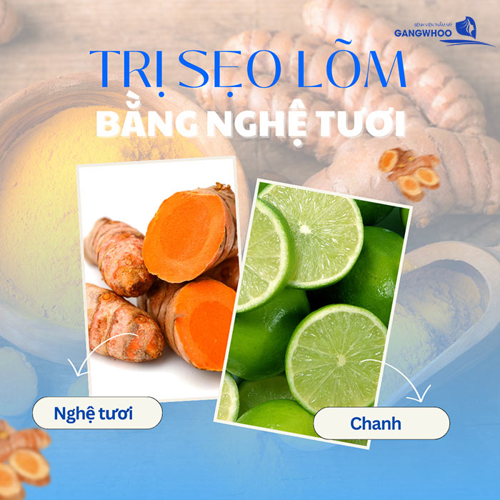 6 Cách Trị Sẹo Lõm Bằng Nghệ Tươi Tại Nhà Hiệu Quả 5 Trị Sẹo Lõm Bằng Nghệ Tươi