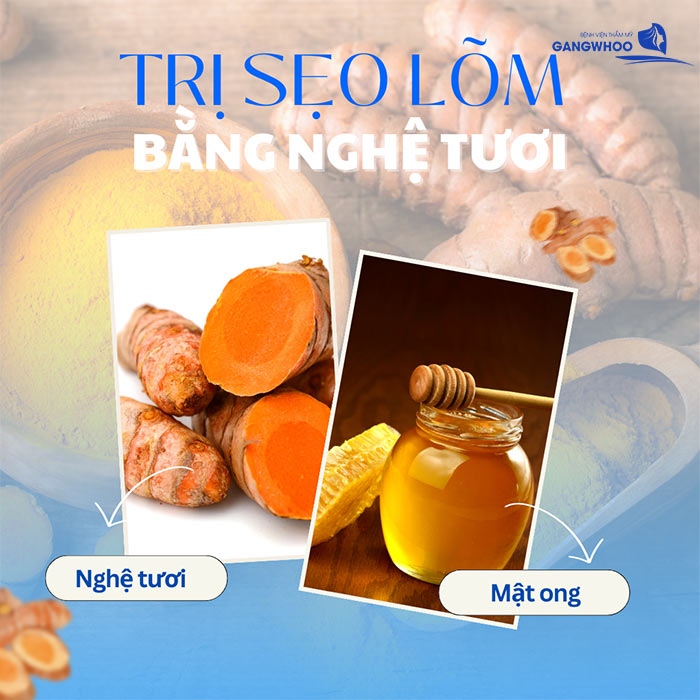 6 Cách Trị Sẹo Lõm Bằng Nghệ Tươi Tại Nhà Hiệu Quả 3 Trị Sẹo Lõm Bằng Nghệ Tươi