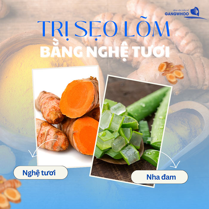 6 Cách Trị Sẹo Lõm Bằng Nghệ Tươi Tại Nhà Hiệu Quả 4 Trị Sẹo Lõm Bằng Nghệ Tươi