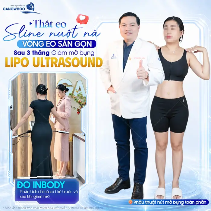 Thắt eo S Line nuột nà vòng eo đẹp săn gọn sau 3 tháng giảm mỡ bụng áp dụng công nghệ Lipo Ultrasound