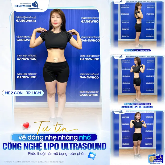 Tự tin thả dáng nhẹ nhàng nhờ công nghệ Lipo Ultrasound tự tin pose dáng với đường cong đẹp chuẩn tỷ lệ