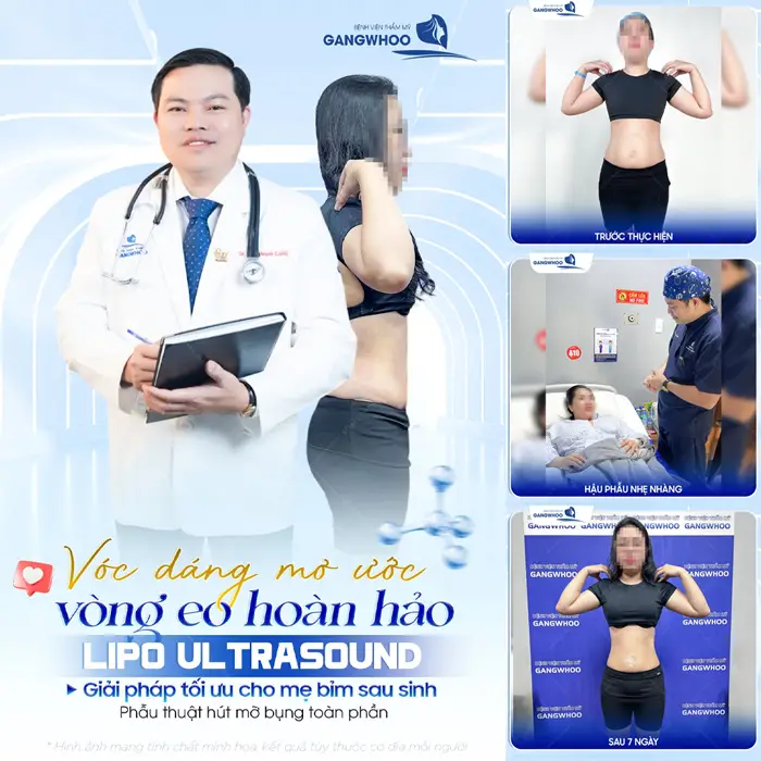 Có Nên Hút Mỡ Bụng Sau Sinh Em Bé Không? Bác Sĩ Giải Đáp 6 Vóc dáng đáng mơ ước với vòng eo đẹp hoàn hảo sau phẫu thuật hút mỡ bụng công nghệ Lipo Ultrasound