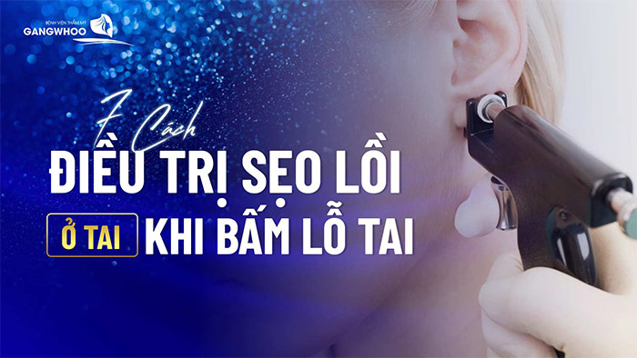 dieu tri seo loi o tai