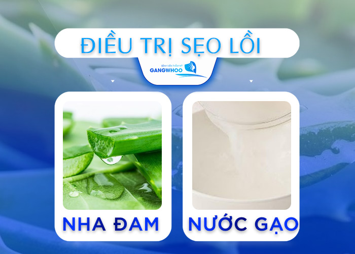 Top 5 Cách Dùng Nha Đam Trị Sẹo Lồi Hiệu Quả Tại Nhà 11 Nha Đam Trị Sẹo Lồi