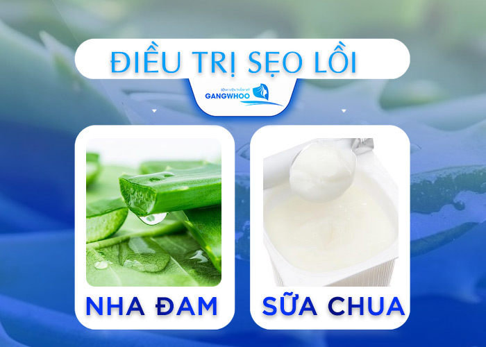 Top 5 Cách Dùng Nha Đam Trị Sẹo Lồi Hiệu Quả Tại Nhà 10 Nha Đam Trị Sẹo Lồi