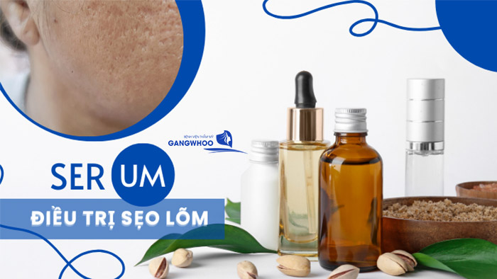 serum dieu tri seo lom