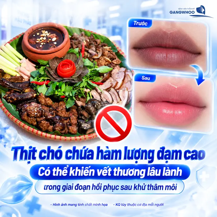 Khử Thâm Môi Kiêng Ăn Gì? Nên Ăn Gì Để Môi Quyến Rũ