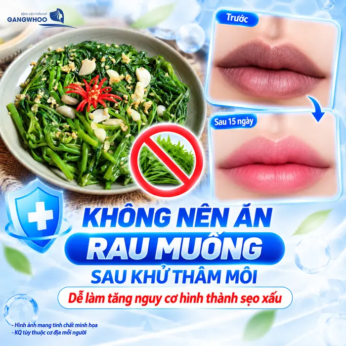 Khử Thâm Môi Kiêng Ăn Gì? Nên Ăn Gì Để Môi Quyến Rũ
