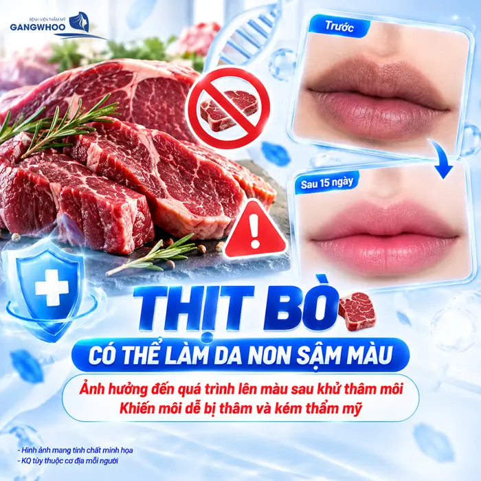 Khử Thâm Môi Kiêng Ăn Gì? Nên Ăn Gì Để Môi Quyến Rũ