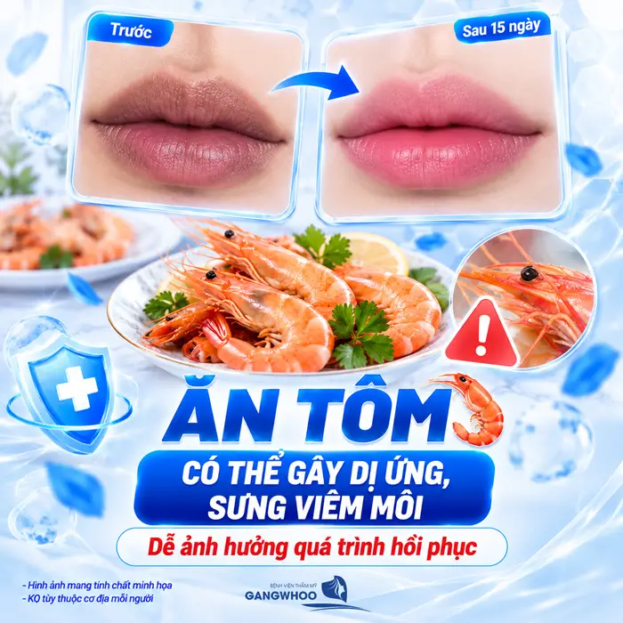 Khử Thâm Môi Kiêng Ăn Gì? Nên Ăn Gì Để Môi Quyến Rũ