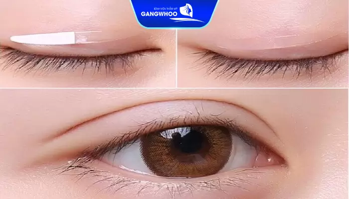 Dụng Cụ Nhấn Mí Mắt Có Thật Sự "Thần Kỳ" Như Quảng Cáo? 10 Sử dụng dụng cụ nhấn mí tạo hình nét mí to đẹp nhanh chóng, dễ dàng