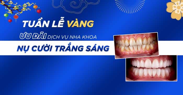 Việc chăm sóc răng miệng quan trọng với sức khỏe mỗi người.