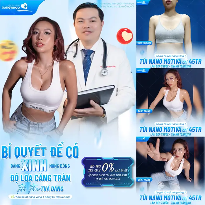 Bí kíp để có dáng xinh nóng bỏng với giải pháp độ loa căng tràn tự tin thả dáng đẹp xuất sắc không lo áp lực chi phí