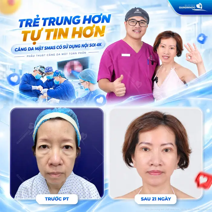 Diện mạo trẻ gương mặt tươi tắn nhờ căng da mặt Smas có sử dụng nội soi 4K