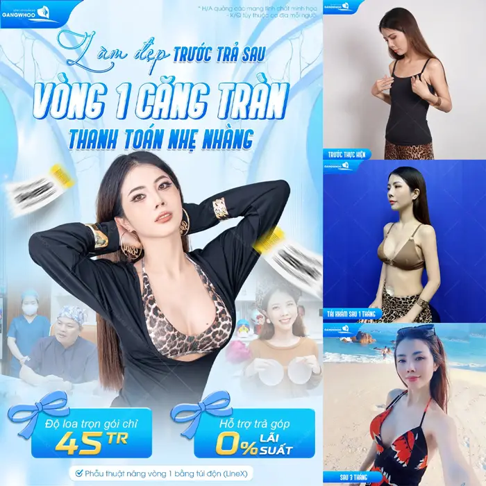 Làm đẹp trước trả sau vòng 1 đẹp căng tràn thanh thoán với chi phí nhẹ nhàng