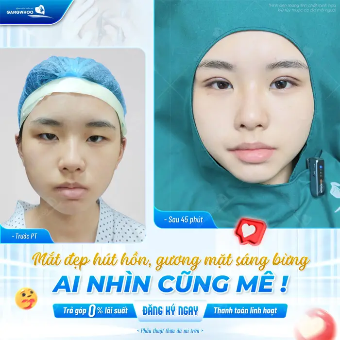 Mắt đẹp hút hồn, gương mặt thêm bừng sáng ai nhìn cũng thích mê trả góp 0% lãi suất, hỗ trợ thanh toán linh hoạt
