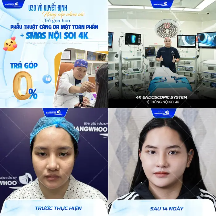 U30 quyết định nâng mũi để trẻ hóa diện mạo thăng cấp nhan sắc đẹp cuốn hút chỉ sau 1 lần thực hiện 