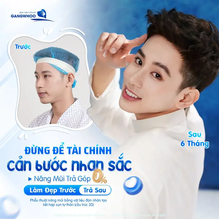 Nâng mũi trả góp làm đẹp an toàn nhan sắc thăng hạng tương lãi thêm vững chãi