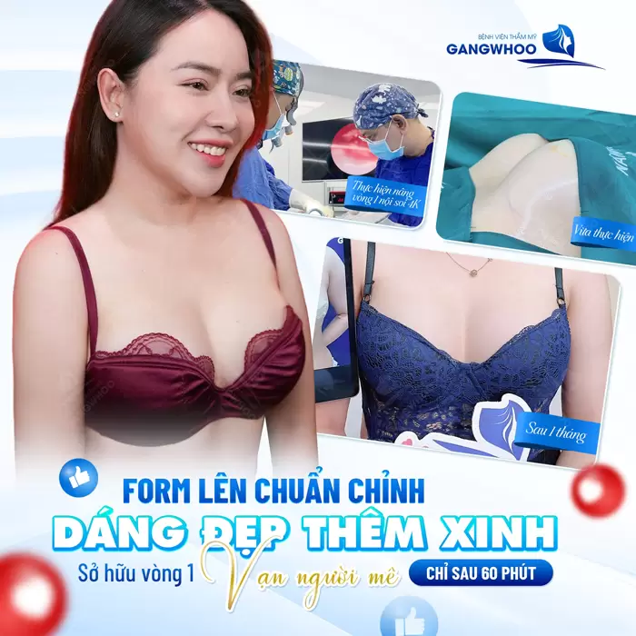 Top 5 Địa Chỉ Nâng Ngực Trả Góp Uy Tín Tại TPHCM 1 Form ngực lên chuẩn đẹp sắc vóc thêm mặn mà ai cũng say mê sau 60 phút thực hiện