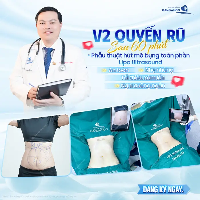 Tự tin khoe vòng 2 quyến rũ sau 60 phút phẫu thuật hút mỡ bụng toàn phần bụng xẹp, eo thon ngay sau thực hiện 