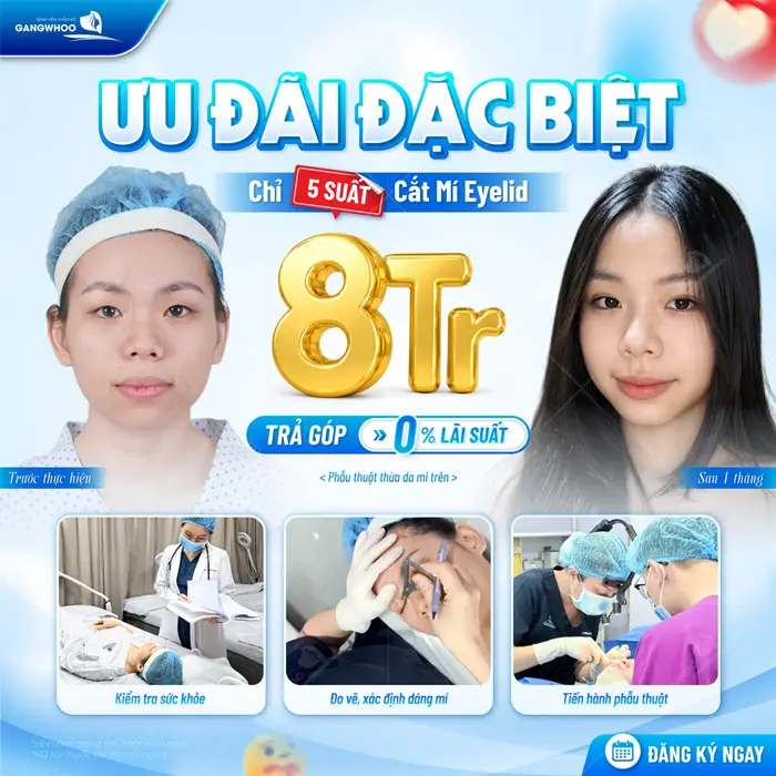 Top 3 Địa Chỉ Cắt Mí Trả Góp Giá Rẻ Tại TPHCM 1 Cắt mí trả góp lãi suất 0% với quy trình chuẩn hóa yên tâm sở hữu mắt đẹp không lo áp lực tài chính