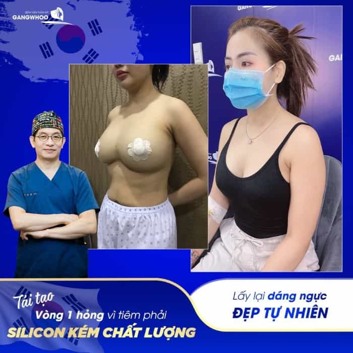 Ms. Quynh (District 7, HCM City) feels happy after a successful breast augmentation.