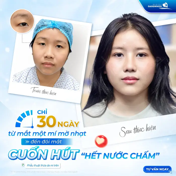 Chỉ sau 30 ngày từ ánh mắt mờ nhạt đến thần thái cuốn hút sau thực hiện