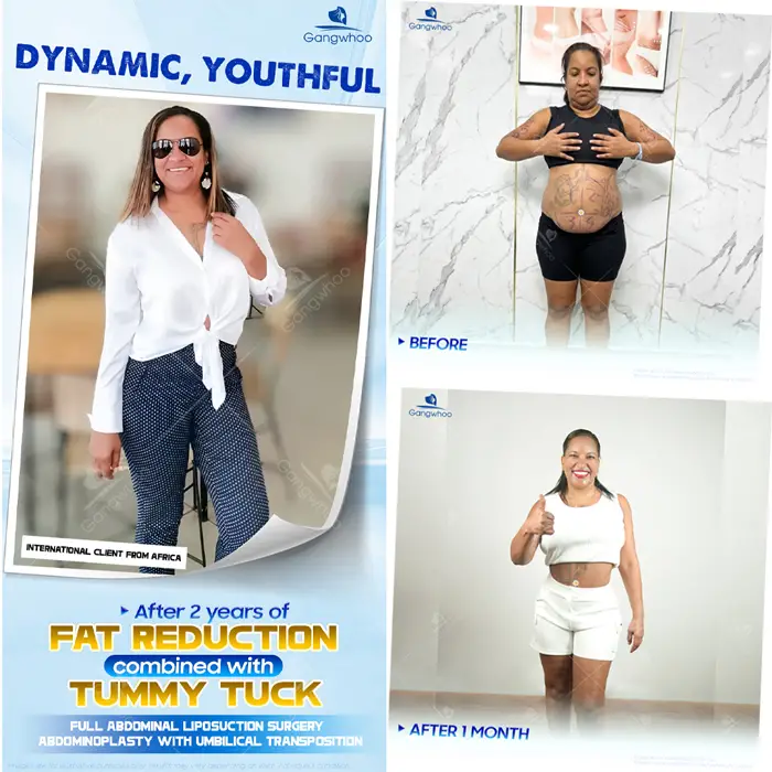 Top 10 Cosmetic Facilities For Safe Abdominal Liposuction in HCM City 3 en dia chi hut mo bung an toan 4