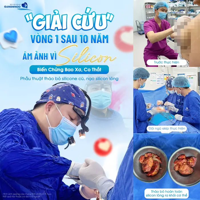 Sửa Ngực Hỏng - 5 Dấu Hiệu Ngực Hỏng Và Cách Điều Trị 12 Giải cứu vòng 1 sau 10 năm biến chứng bao xơ, co thắt tại BVTM Gangwhoo khôi phục lại sự tự tin dài lâu