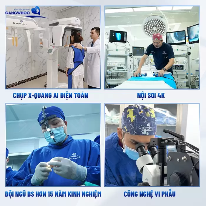 16 Địa Chỉ Nâng Mũi Đẹp Ở Sài Gòn (TPHCM) 34 16 Địa Chỉ Nâng Mũi Đẹp Ở Sài Gòn (TPHCM)