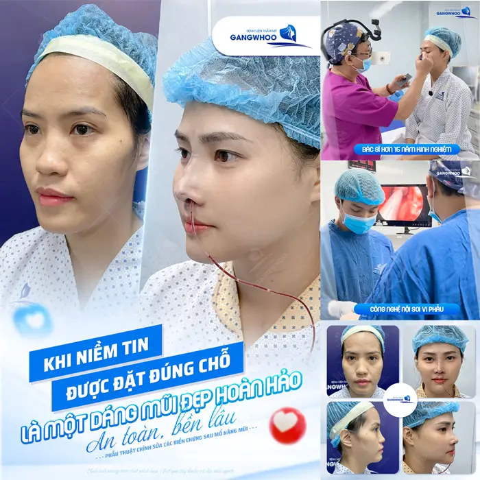 Khi niềm tin đặt đúng chỗ luôn yên tâm với dáng mũi đẹp hoàn hảo, an toàn và bền lâu 