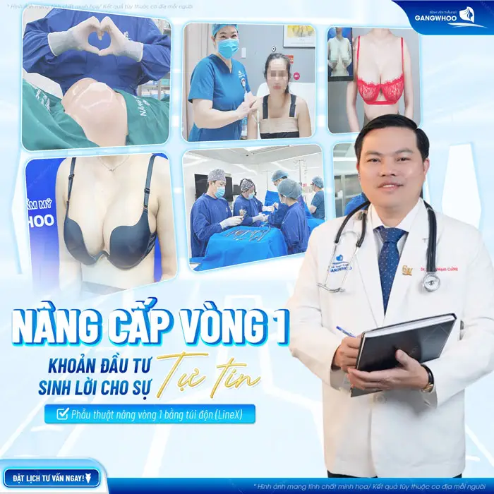 Phẫu Thuật Nội Soi Nâng Ngực (Nâng Ngực Bằng Túi Arion Vi Nhám) An Toàn Hiệu Quả 4 Phẫu thuật nâng cấp vòng bằng túi độn khoản đầu tư sinh lời cho sự tự tin dài lâu