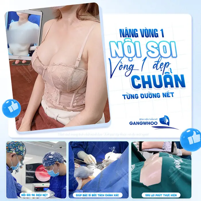 Nâng vòng 1 nội soi vòng 1 đẹp chuẩn từng nét đầy căng tròn và quyến rũ