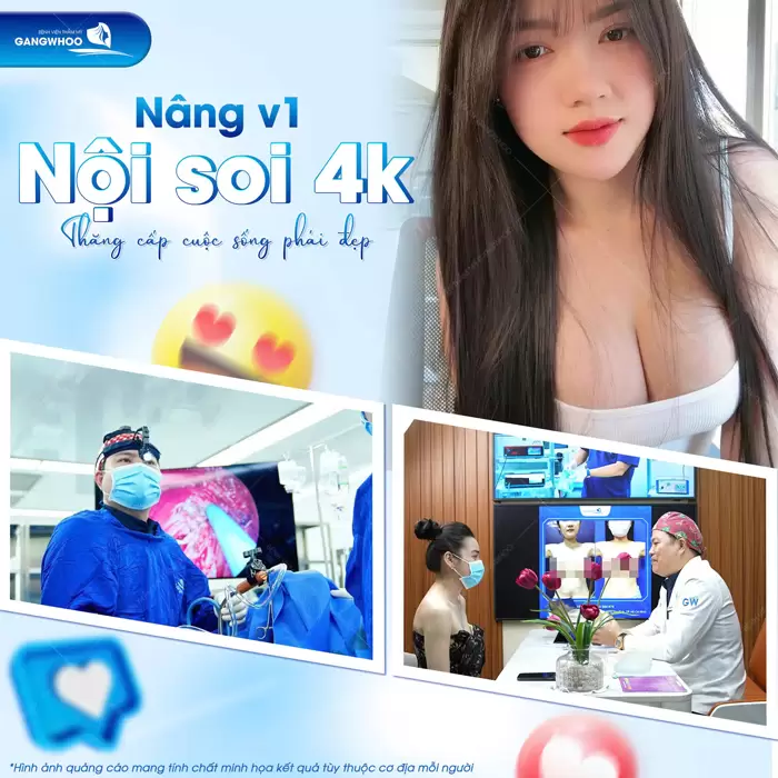 Nâng vòng 1 nội soi 4K thăng cấp cuộc sống, nâng cấp diện mạo đầy cuốn hút