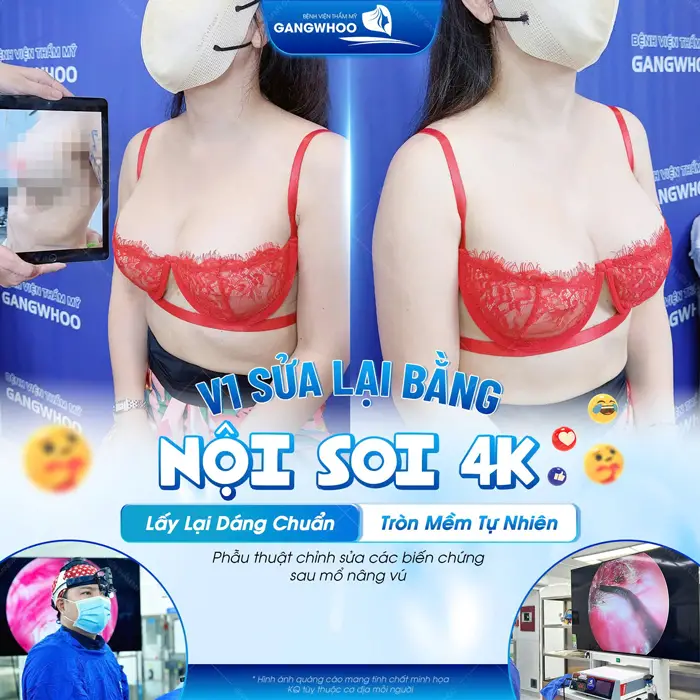 Sửa Ngực Hỏng - 5 Dấu Hiệu Ngực Hỏng Và Cách Điều Trị 10 Vòng 1 sửa lại bằng công nghệ nội soi 4K lấy láy dáng chuẩn tròn mềm tự nhiên, đẹp hài hòa với cơ thể