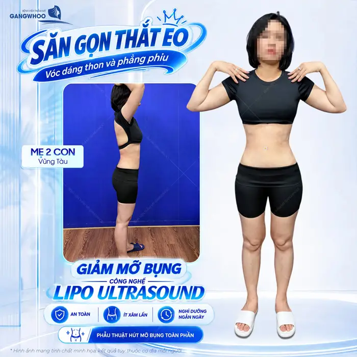 Giảm mỡ bụng công nghệ Lipo Ultrasound săn gọn thắt eo vóc dáng thon đẹp tôn lên vóc dáng nuột nà cực cuốn hút