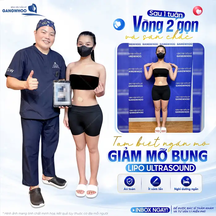 Tạm biệt ngấn mỡ sau giảm mỡ bụng công nghệ Lipo Ultrasound vòng eo đẹp thon gọn và săn chắc