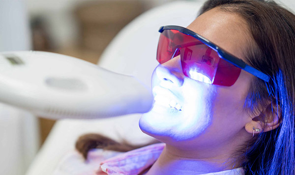 How Long Is Teeth Whitening At Dental Clinics?