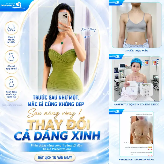 Sau nâng vòng 1 nội soi tại Gangwhoo thay đổi dáng xinh diện mạo thêm cuốn hút và thăng hạng đầy rạng rỡ