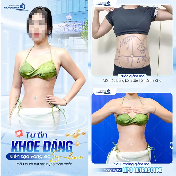 Tự tin khoe dáng kiến tạo vòng eo S Line sau 1 tháng thực hiện đã thăng cấp sắc vóc đẹp chuẩn cuốn hút