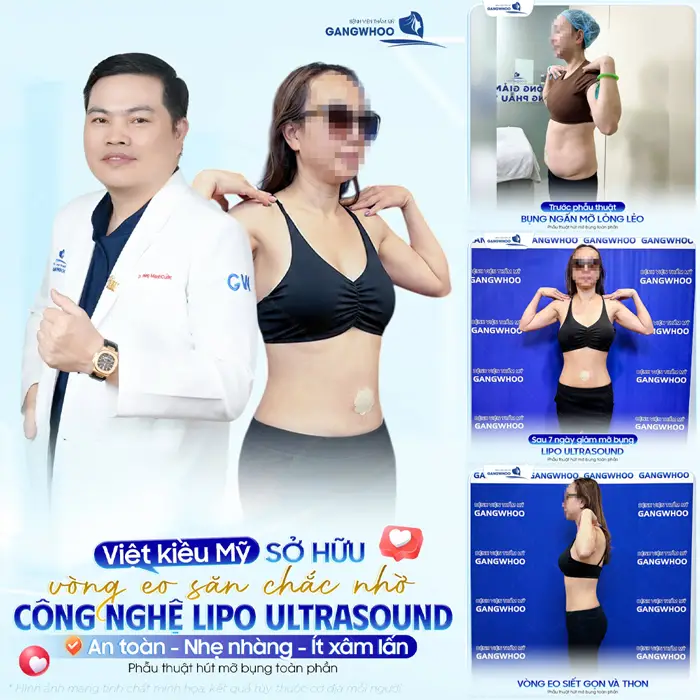 Việt Kiều Mỹ sở hữu vòng eo săn chắc nhờ công nghệ giảm mỡ Lipo Ultrasound hiện đại