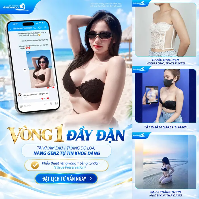 5 Lưu Ý Nâng Ngực An Toàn Để Không Xảy Ra Biến Chứng 7 Vòng 1 đầy đặn tái khám sau 1 tháng độ loa nàng GenZ tự tin khoe dáng thêm xinh đẹp và nuột nà