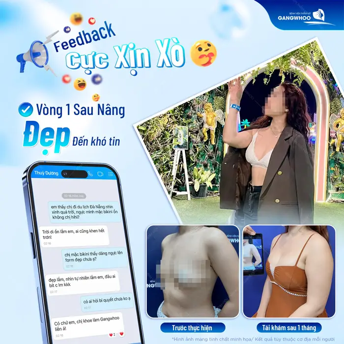 Vòng 1 sau nâng đẹp đến khó tin chỉ sau 1 tháng phẫu thuật đã tự tin diện áo tôn body cực đẹp
