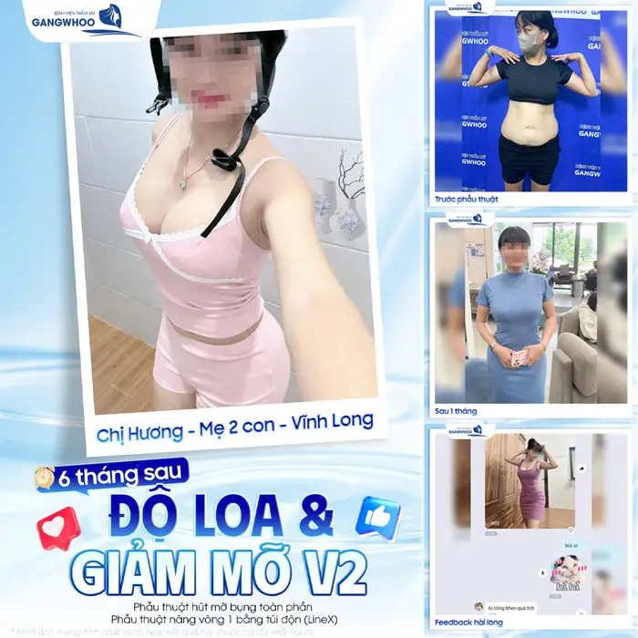 6 tháng sau độ loa giảm mỡ vòng 2 eo thon dáng đẹp mẹ 2 con tự tin selfile với body đẹp nét căng