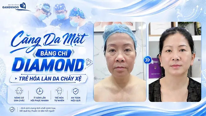 cang da mat bang chi dimond