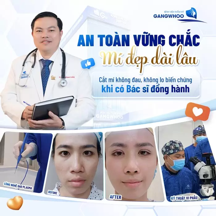Top 8+ Bác Sĩ Cắt Mí Mắt Đẹp, Nổi Tiếng Tại TPHCM 1 Bác sĩ cắt mí