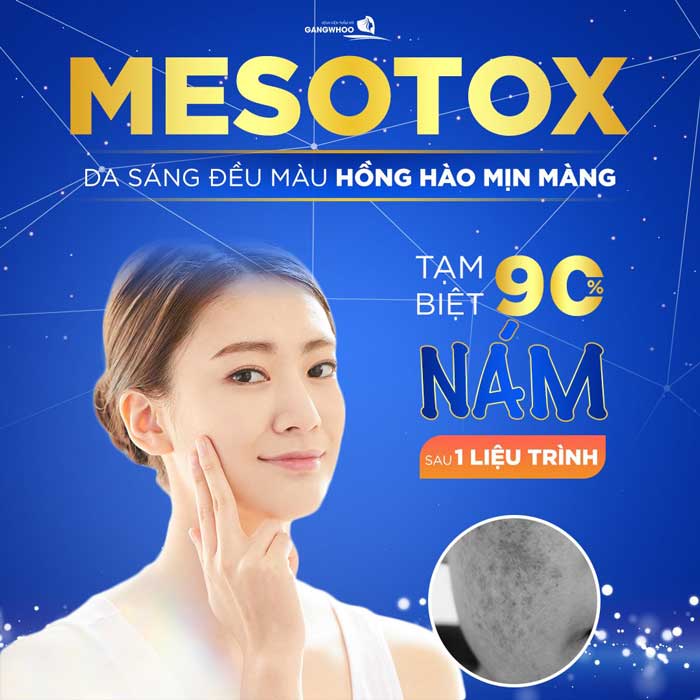 Mesotox Melasma Treatment