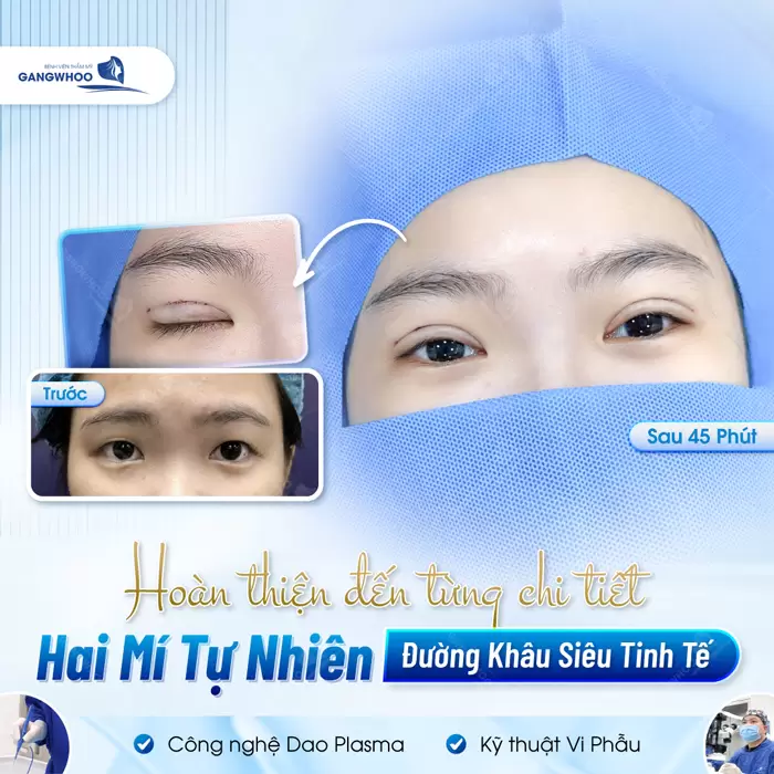 Hoàn thiện ánh mắt đẹp từng chi tiết với đường khâu siêu mảnh và cực tự tin